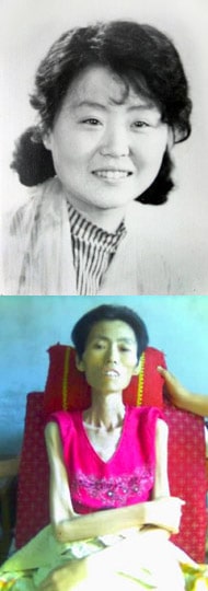 Wei Fengju before being tortured (top), and on July 11, 2007, the day before she passed away (above).