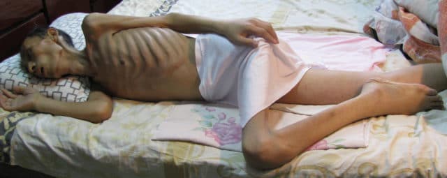 An emaciated Mr. Lu Yunlai shortly after being released home from Baimiao labor camp